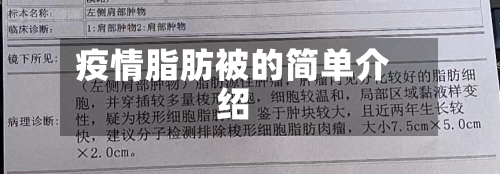 疫情脂肪被的简单介绍-第1张图片