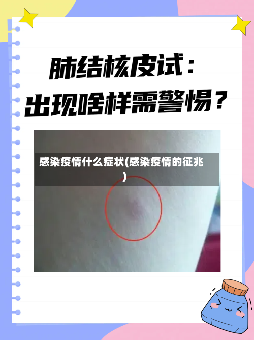 感染疫情什么症状(感染疫情的征兆)-第2张图片