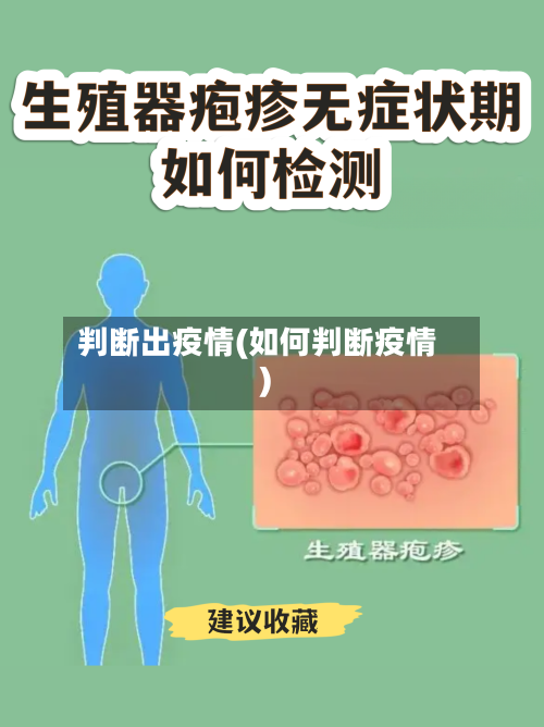 判断出疫情(如何判断疫情)-第3张图片